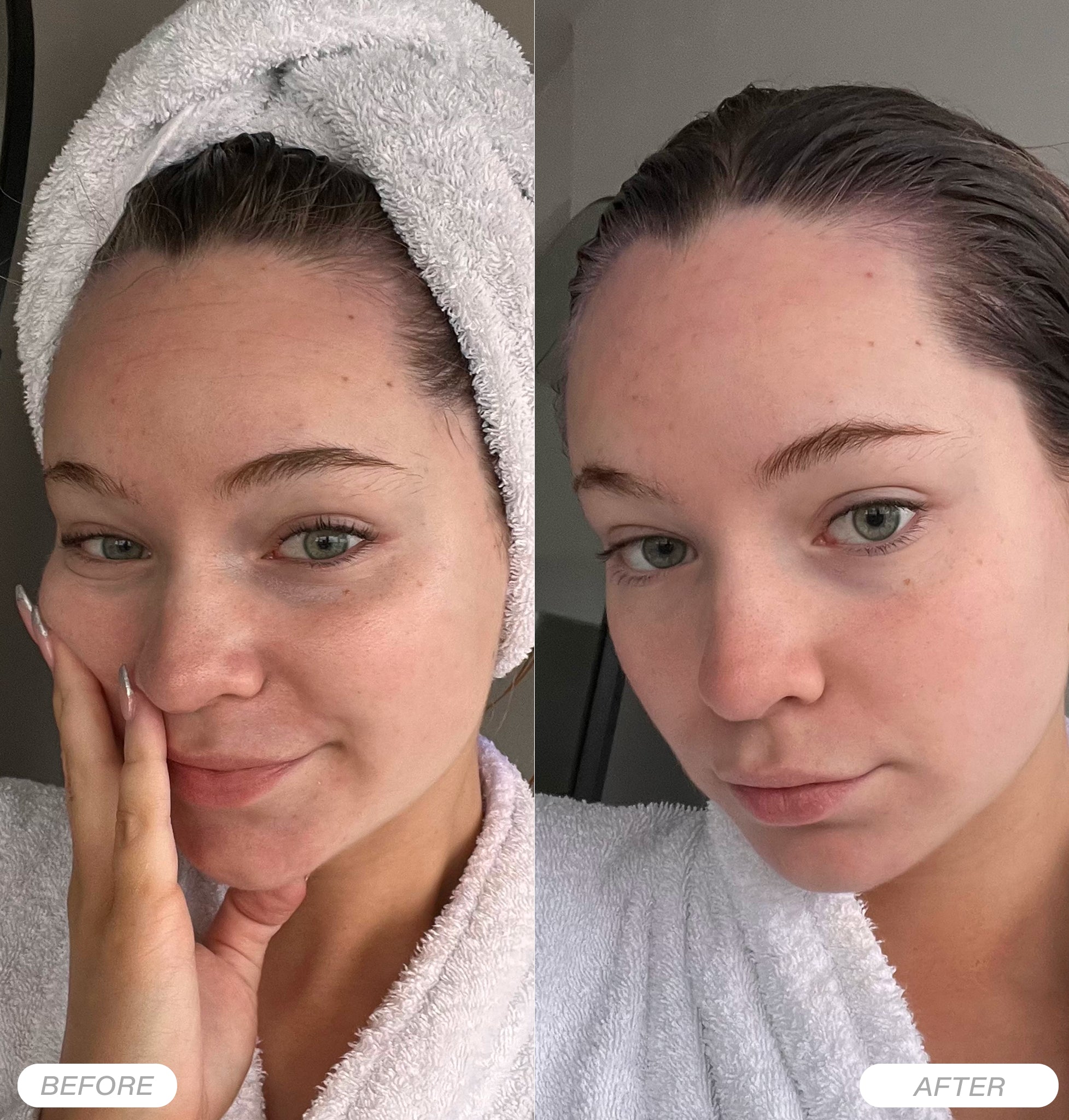 Botanical Lifting Effect Serum | with Hyaluron & Caffeine