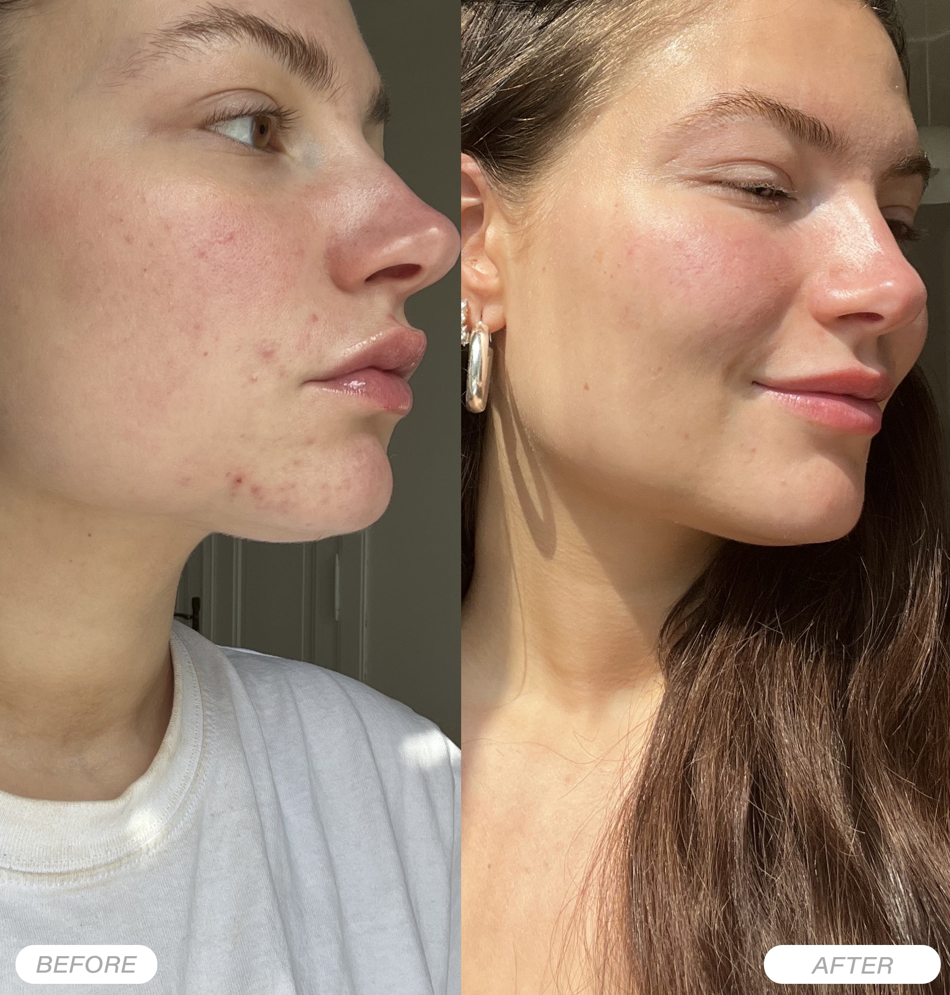 Rosental Organics - Bakuchiol Serum | Clarifying Concentrate