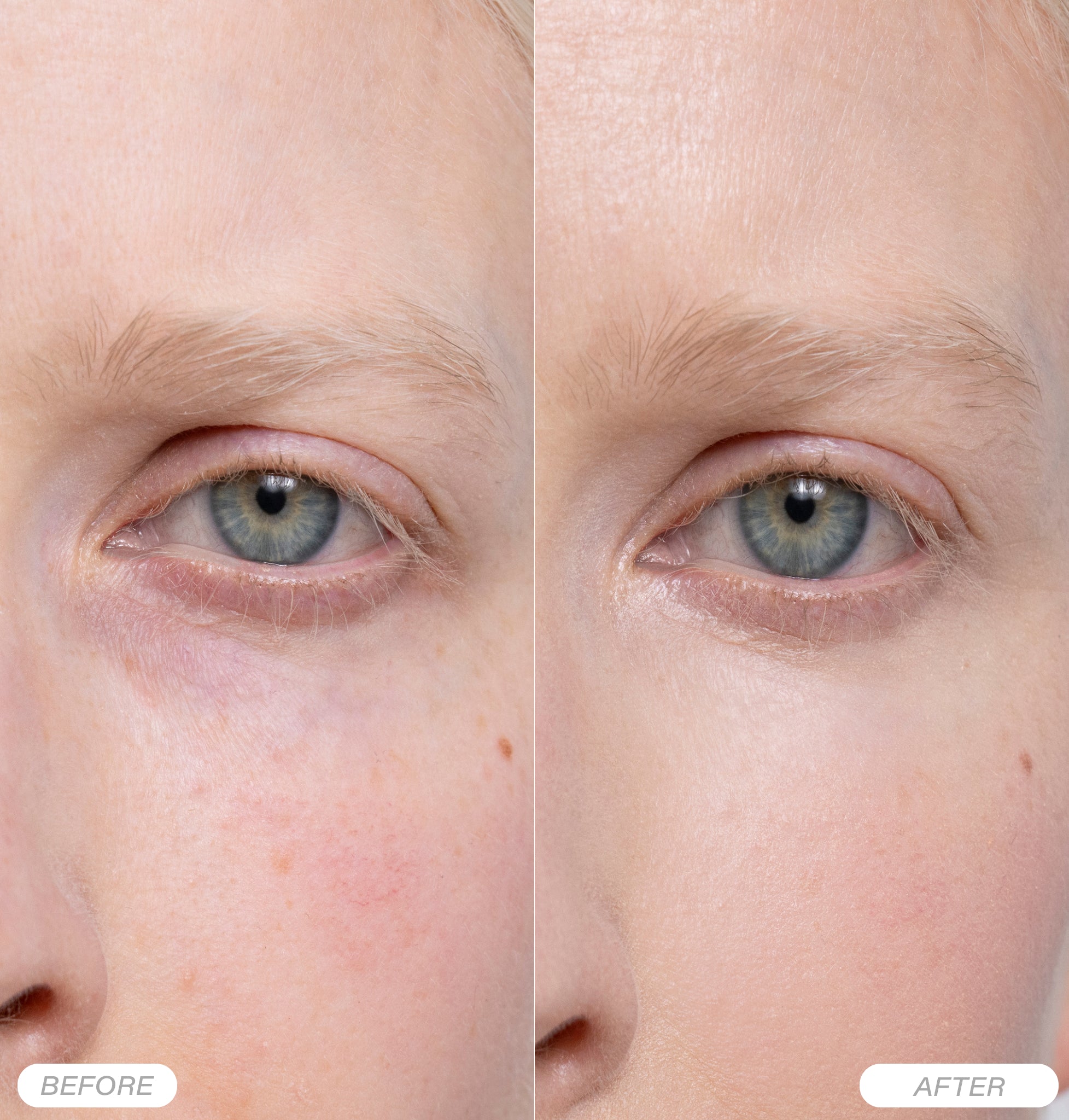 Rosental Organics - Hyaluron Eye Cream | Slow-Aging Treatment