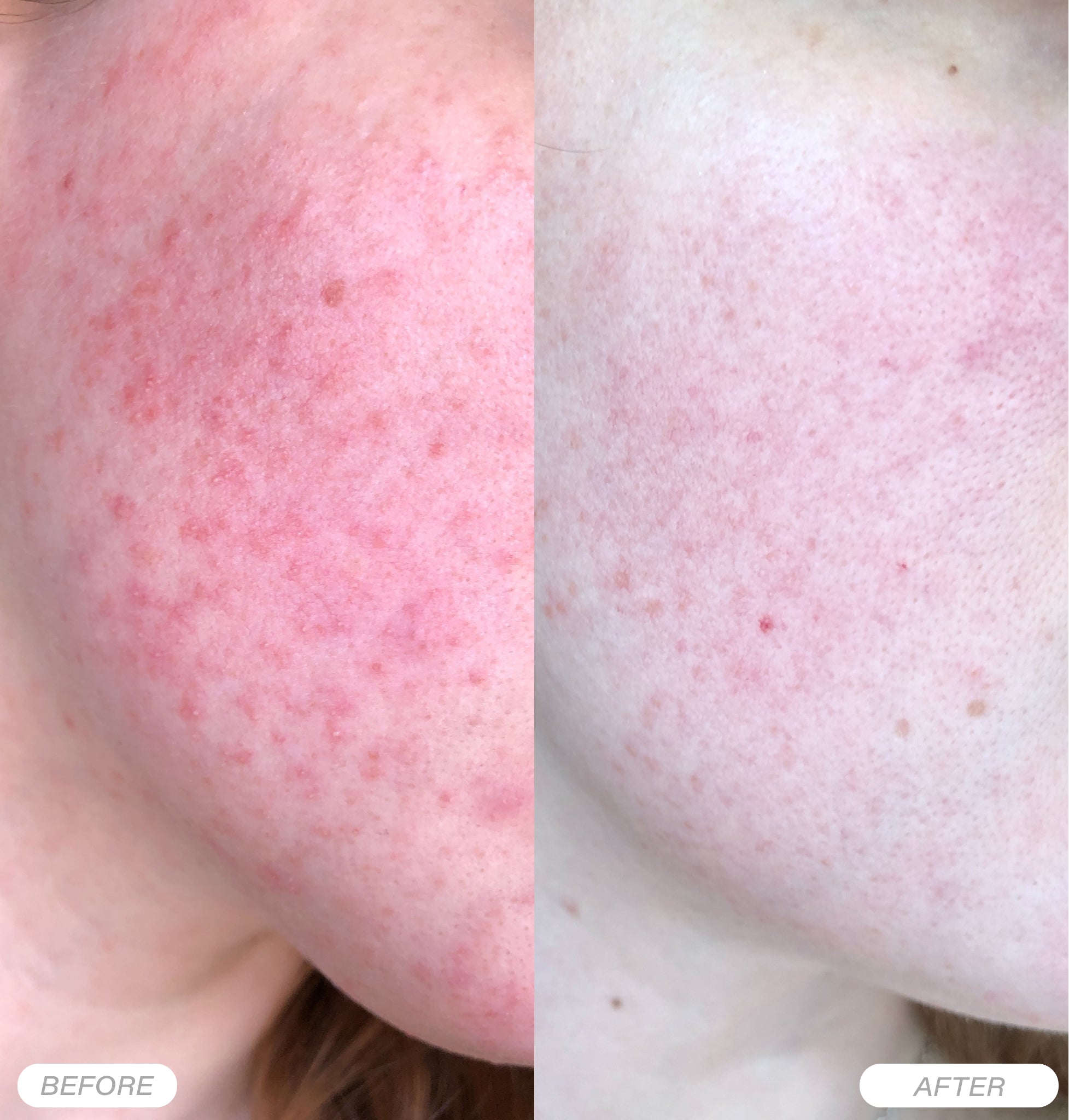 Rosental Organics - Niacinamide Serum | Pore-Refining Concentrate