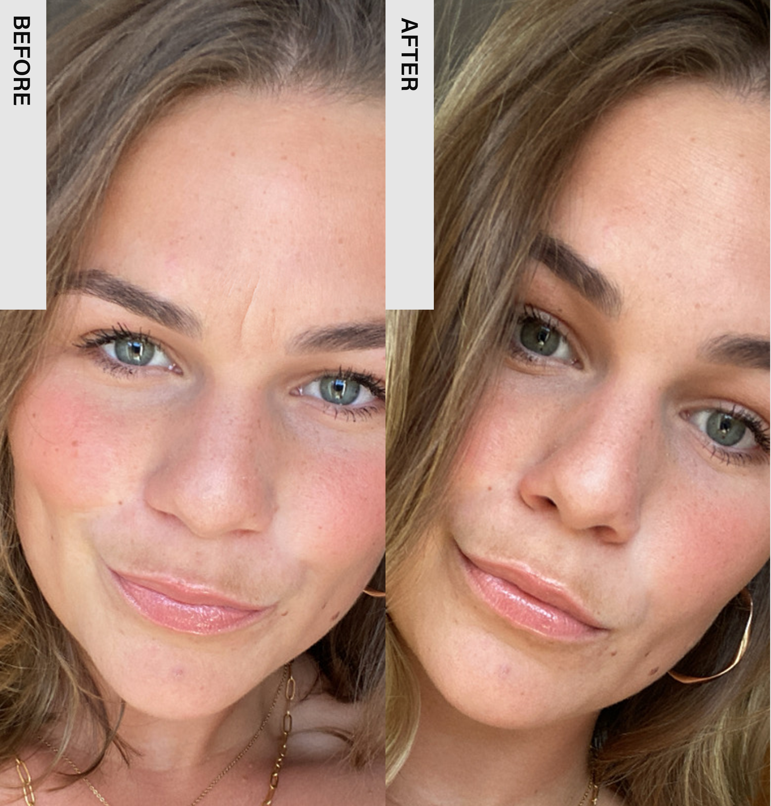 EMS Face Massage Duo